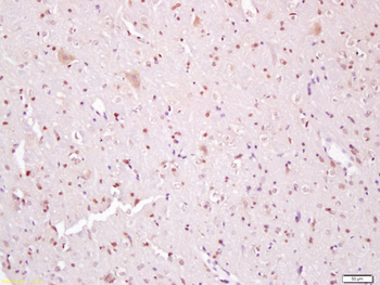 Phospho-beta catenin (Tyr142) Rabbit Polyclonal Antibody