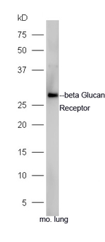 CLEC7A Rabbit Polyclonal Antibody