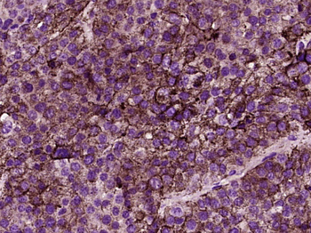 CD26 Rabbit Polyclonal Antibody