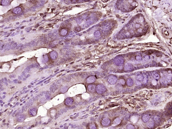 CD26 Rabbit Polyclonal Antibody