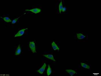 IL-2R gamma Rabbit Polyclonal Antibody