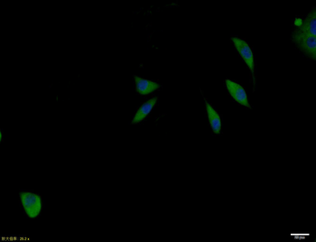 IL-2R gamma Rabbit Polyclonal Antibody