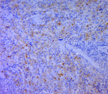 CD5L Rabbit Polyclonal Antibody