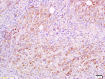 CD5L Rabbit Polyclonal Antibody