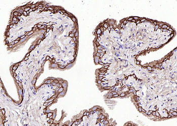 CK7 Rabbit Polyclonal Antibody