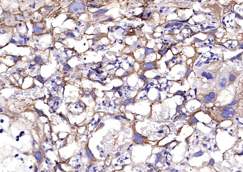 CK7 Rabbit Polyclonal Antibody