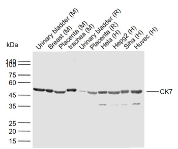 CK7 Rabbit Polyclonal Antibody