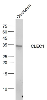 CLEC1 Rabbit Polyclonal Antibody