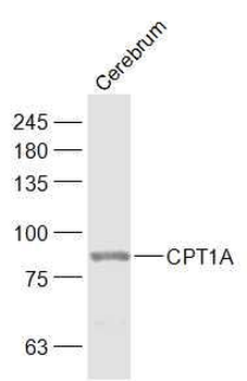 CPT1A Rabbit Polyclonal Antibody