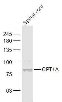 CPT1A Rabbit Polyclonal Antibody
