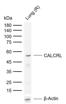 CALCRL Rabbit Polyclonal Antibody