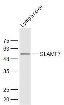 SLAMF7 Rabbit Polyclonal Antibody