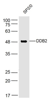 DDB2 Rabbit Polyclonal Antibody