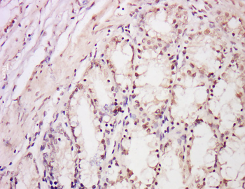 DDB2 Rabbit Polyclonal Antibody