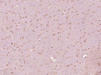 Phospho-eIF4E (Ser209) Rabbit Polyclonal Antibody