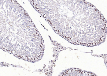 Phospho-eIF4E (Ser209) Rabbit Polyclonal Antibody