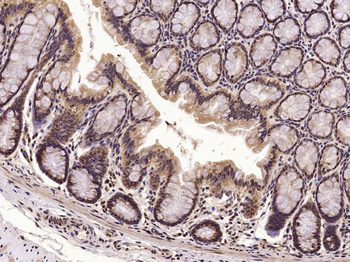 MKP1 Rabbit Polyclonal Antibody