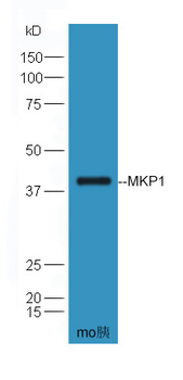 MKP1 Rabbit Polyclonal Antibody