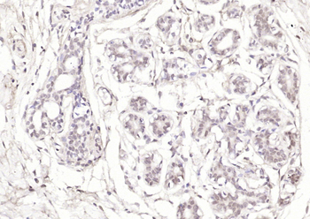 Phospho-Estrogen Receptor alpha (Ser167) Rabbit Polyclonal Antibody