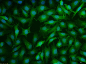 Estrogen Receptor alpha Rabbit Polyclonal Antibody