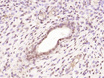 Estrogen Receptor alpha Rabbit Polyclonal Antibody