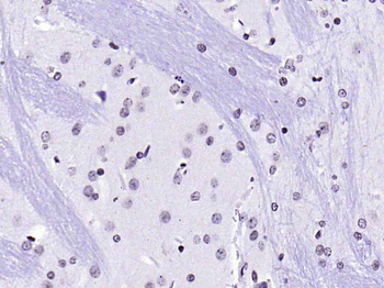 HFH4 Rabbit Polyclonal Antibody