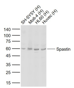 Spastin Rabbit Polyclonal Antibody