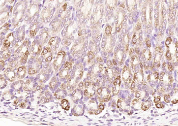 CCKBR Rabbit Polyclonal Antibody