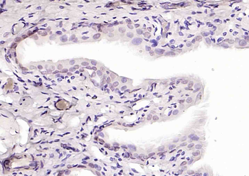 GATA5 Rabbit Polyclonal Antibody