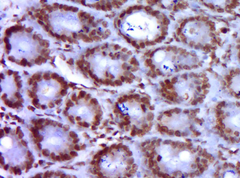 GATA5 Rabbit Polyclonal Antibody