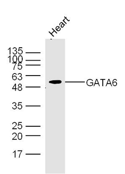 GATA6 Rabbit Polyclonal Antibody