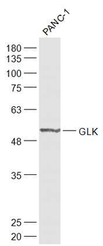 GLK Rabbit Polyclonal Antibody