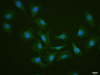 GLUT12 Rabbit Polyclonal Antibody