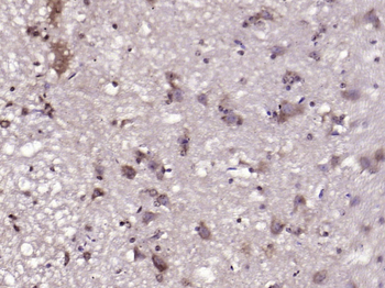 GLUT12 Rabbit Polyclonal Antibody
