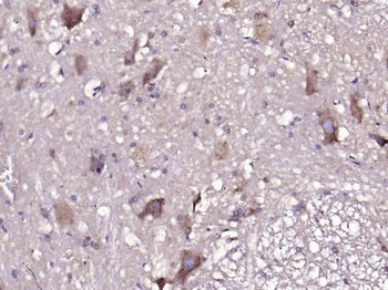 GLUT12 Rabbit Polyclonal Antibody