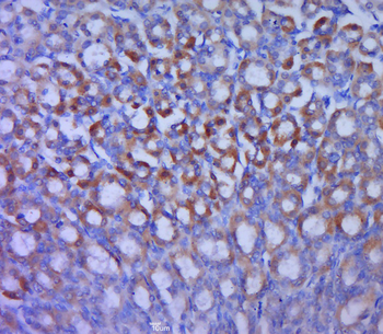 GLUT12 Rabbit Polyclonal Antibody