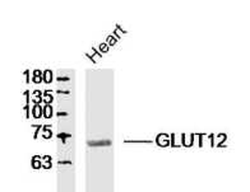 GLUT12 Rabbit Polyclonal Antibody