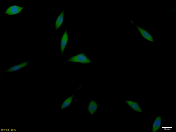 GLUT12 Rabbit Polyclonal Antibody