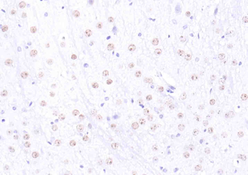 H2AX Rabbit Polyclonal Antibody