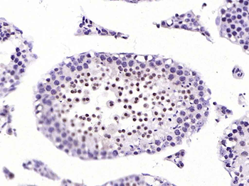 H2AX Rabbit Polyclonal Antibody