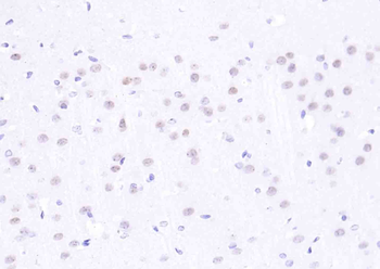 H2AX Rabbit Polyclonal Antibody