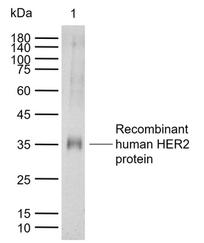 HER2 Rabbit Polyclonal Antibody