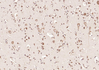 HDAC2 Rabbit Polyclonal Antibody