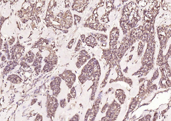 HDAC2 Rabbit Polyclonal Antibody