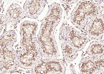 HDAC2 Rabbit Polyclonal Antibody