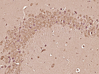 HDAC2 Rabbit Polyclonal Antibody