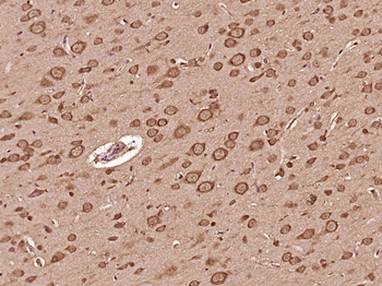 HDAC2 Rabbit Polyclonal Antibody