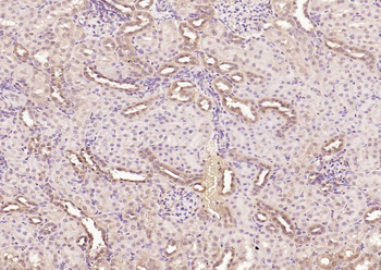 HDAC2 Rabbit Polyclonal Antibody