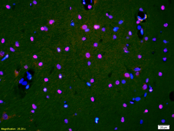 HDAC3 Rabbit Polyclonal Antibody