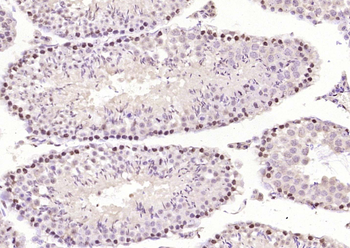HMGB4 Rabbit Polyclonal Antibody